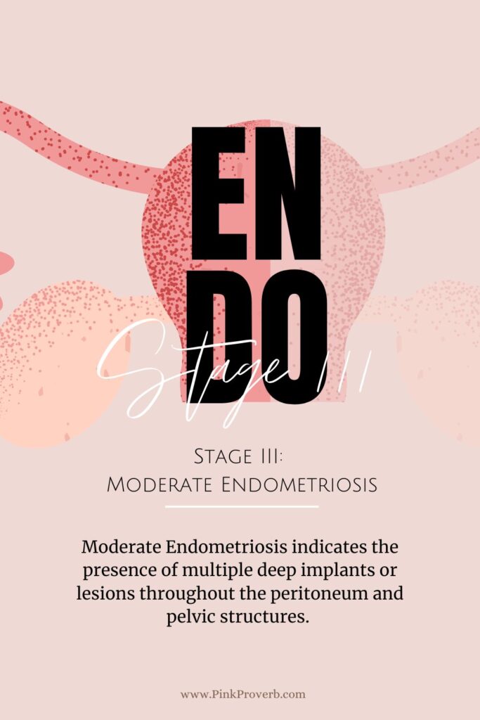 moderate endometriosis_ stage 3_ pink proverb